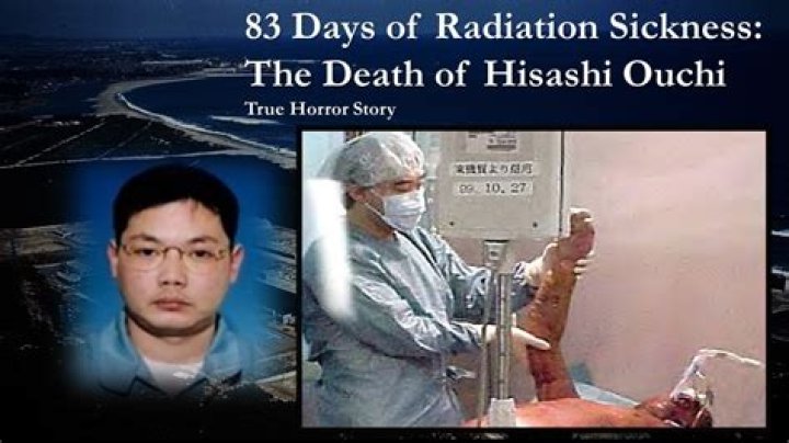 Hisashi Ouchi's Tragic Death: Lessons From Tokaimura Nuclear Accident