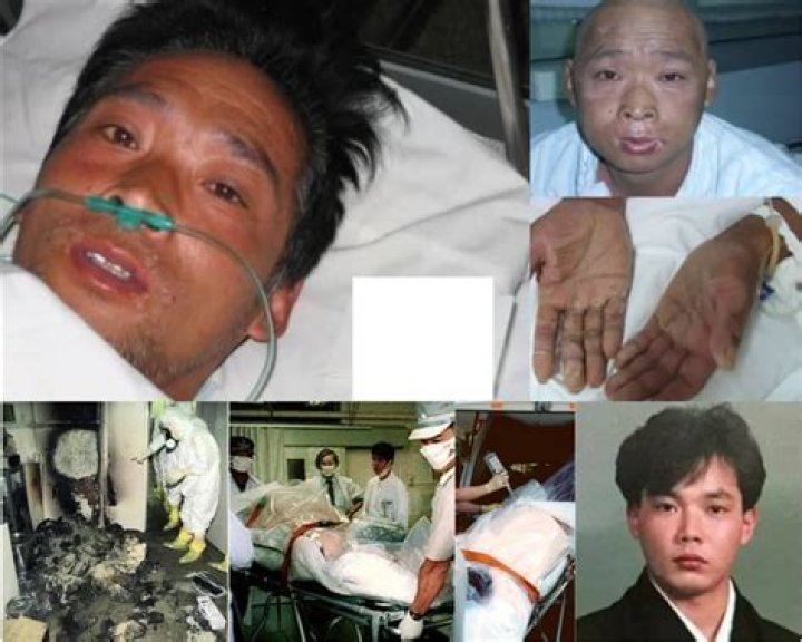 The Tragic Demise Of Hisashi Ouchi: How Did He Perish?