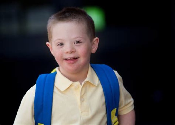 Unveiling The Truth: George Clooney's Down's Syndrome Child